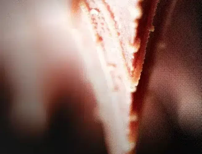 Cual-es-la-diferencia